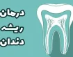 بهترین دکتر عصب کشی دندان در اصفهان اقساطی با وام قرض الحسنه