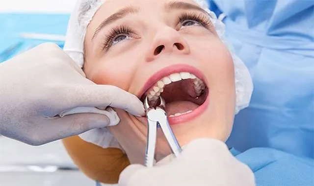 کشیدن دندان توسط بهترین دندانپزشک اصفهان