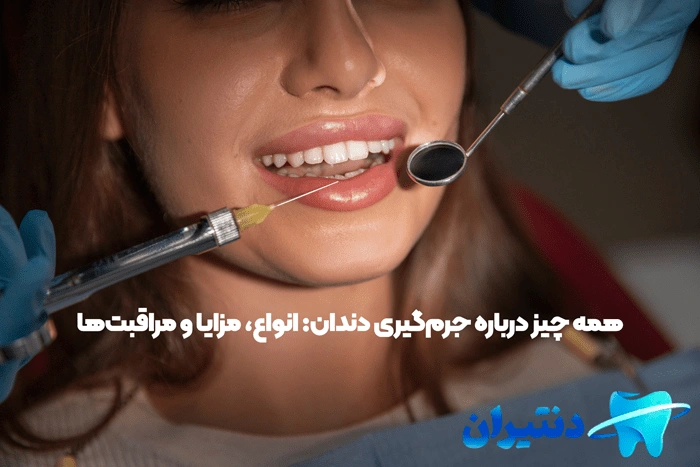 جرم‌گیری دندان