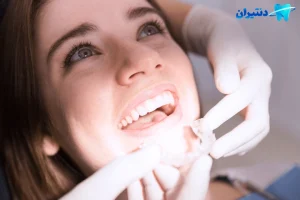  ماندگاری بلیچینگ چقدره؟