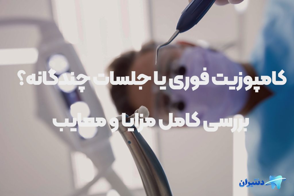 کامپوزیت فوری