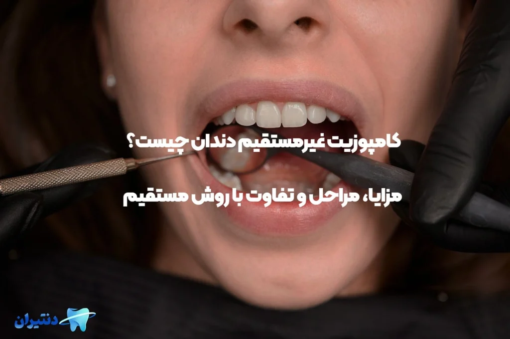 کامپوزیت غیرمستقیم