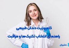 کامپوزیت دندان طبیعی