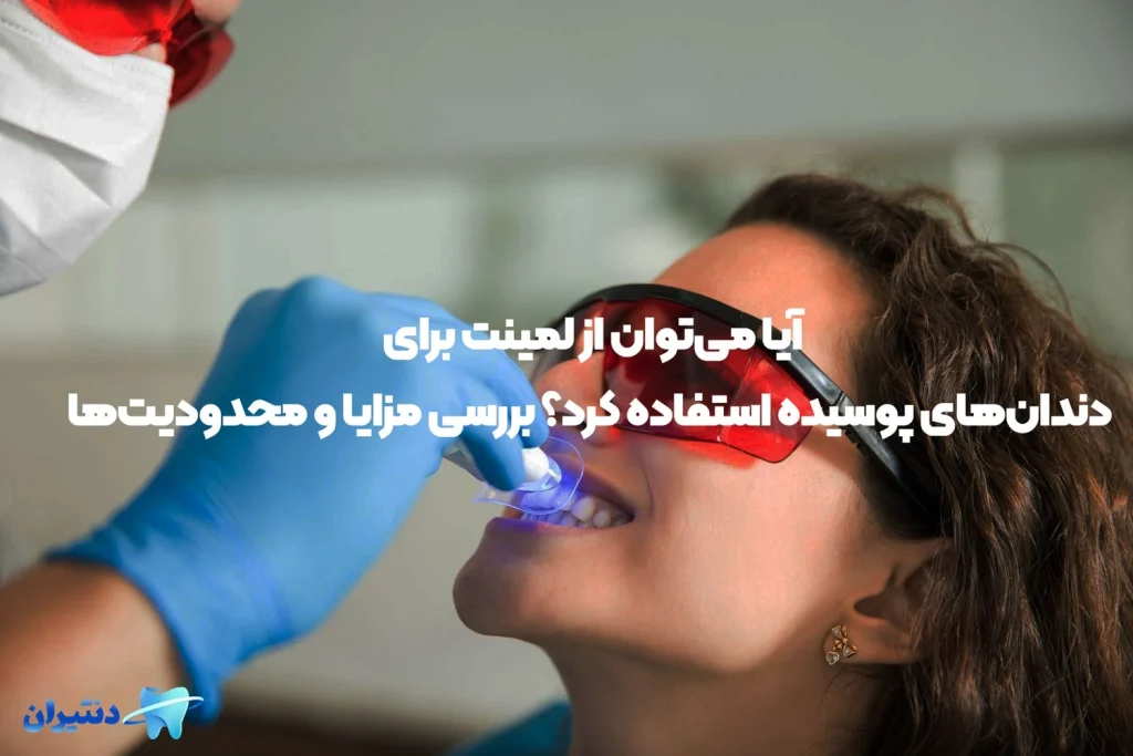 پوسیدگی دندان و لمینت