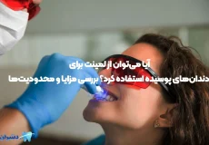 پوسیدگی دندان و لمینت