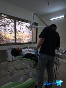 چسب دندان مصنوعی