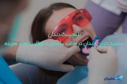 هزینه بلیچینگ دندان در مطب