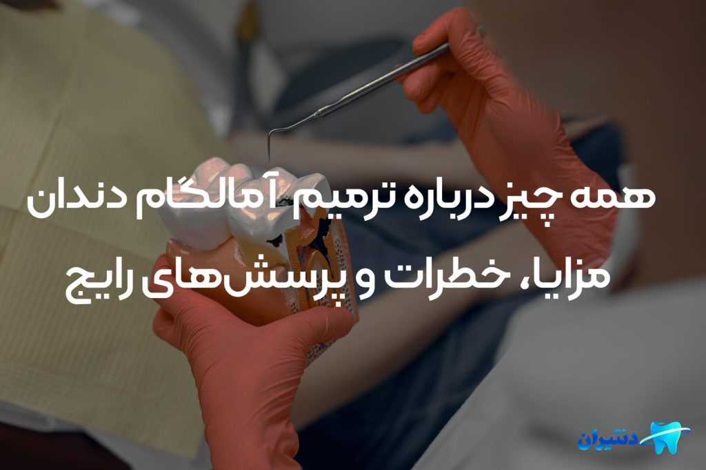 ترمیم آمالگام دندان