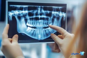 خطرات تصویر برداری CBCT دندانی