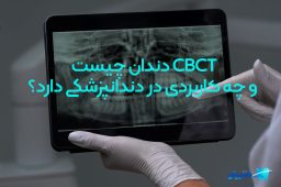 تصویر برداری CBCT