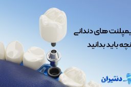 ایمپلنت های دندانی