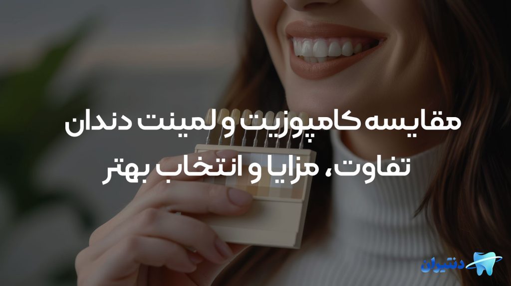 مقایسه کامپوزیت و لمینت