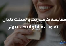 مقایسه کامپوزیت و لمینت