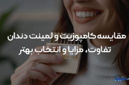 مقایسه کامپوزیت و لمینت