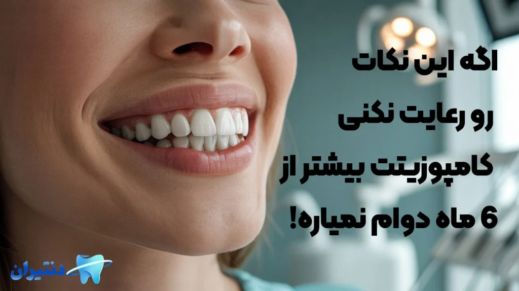 نکات قبل از کامپوزیت دندان