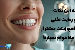 نکات قبل از کامپوزیت دندان