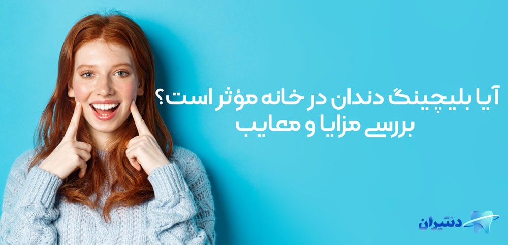 بلیچینگ دندان در خانه