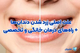 زردی دندان