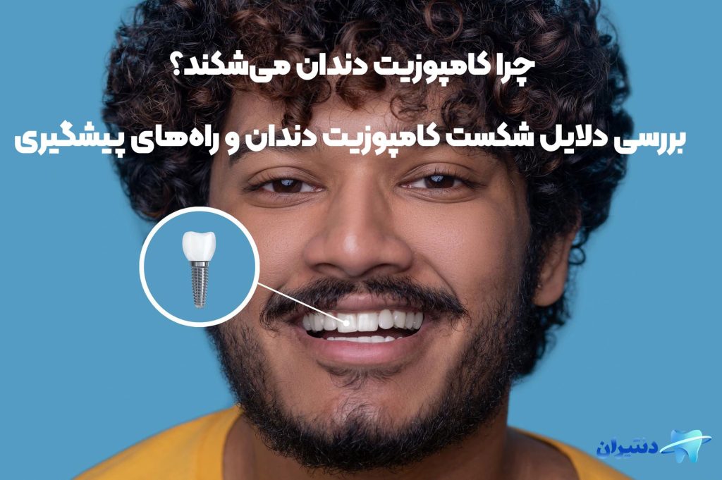 چرا کامپوزیت دندان می‌شکند؟