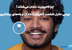 چرا کامپوزیت دندان می‌شکند؟