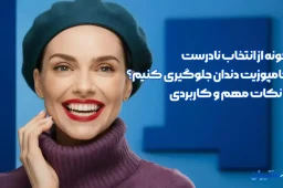 انتخاب نادرست کامپوزیت