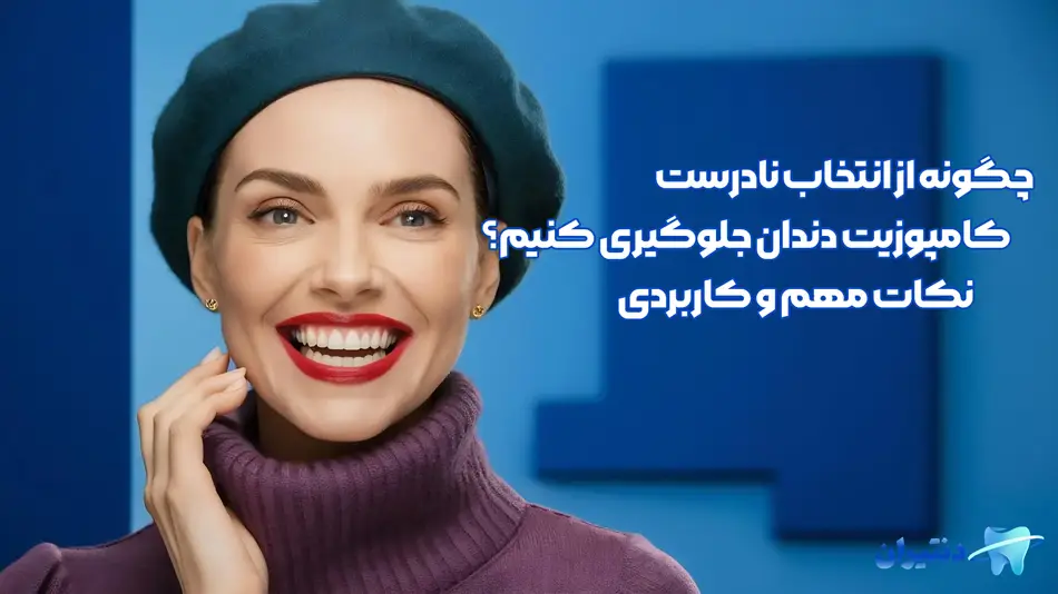 انتخاب نادرست کامپوزیت