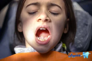 آیا دندان نابالغ کودک قابل حفظ است؟