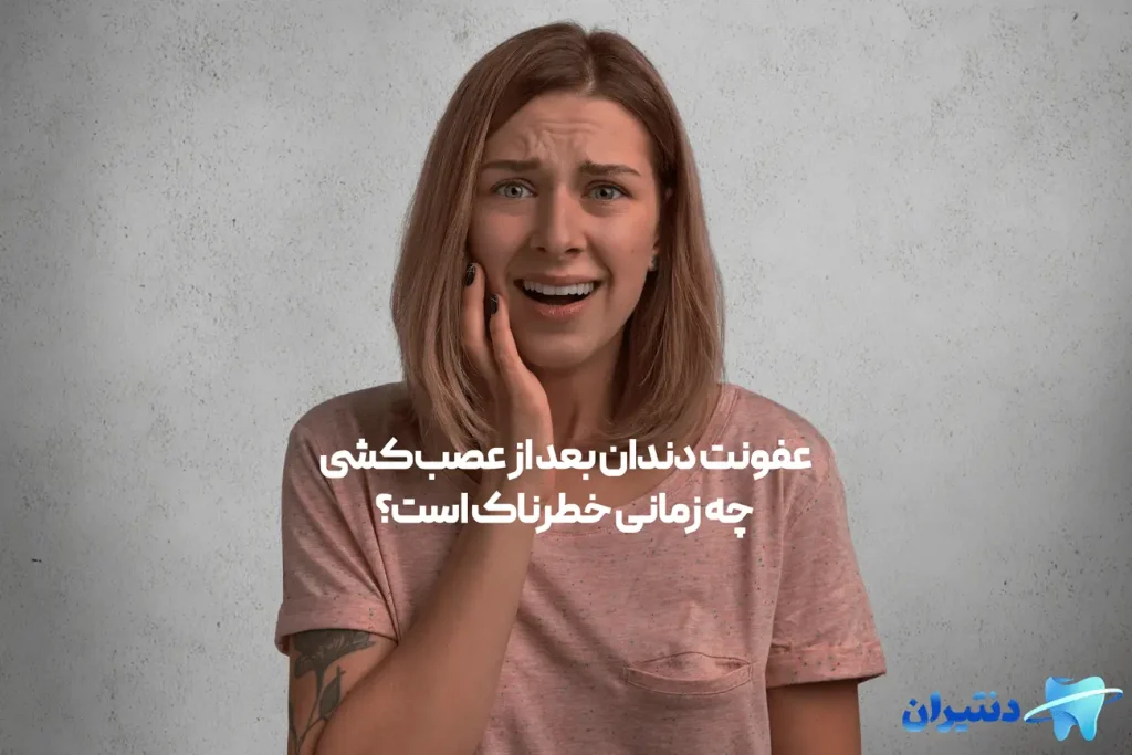 عفونت دندان بعد از عصب‌کشی