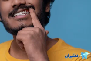 علائم عفونت، آبسه و چرک دندان بعد از عصبکشی