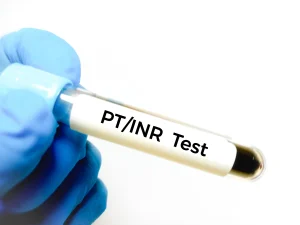 سوالات متداول درباره آزمایش قبل از ایمپلنت