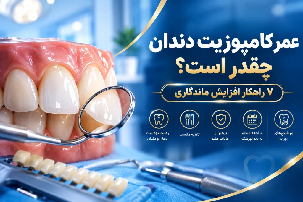 عمر کامپوزیت دندان و ۷ راهکار موثر برای افزایش ماندگاری آن در اصفهان