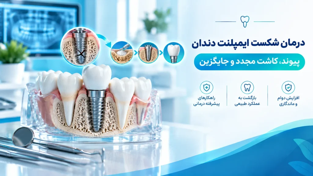 درمان شکست ایمپلنت دندان - مراحل پیوند استخوان، کاشت مجدد و جایگزین ایمپلنت