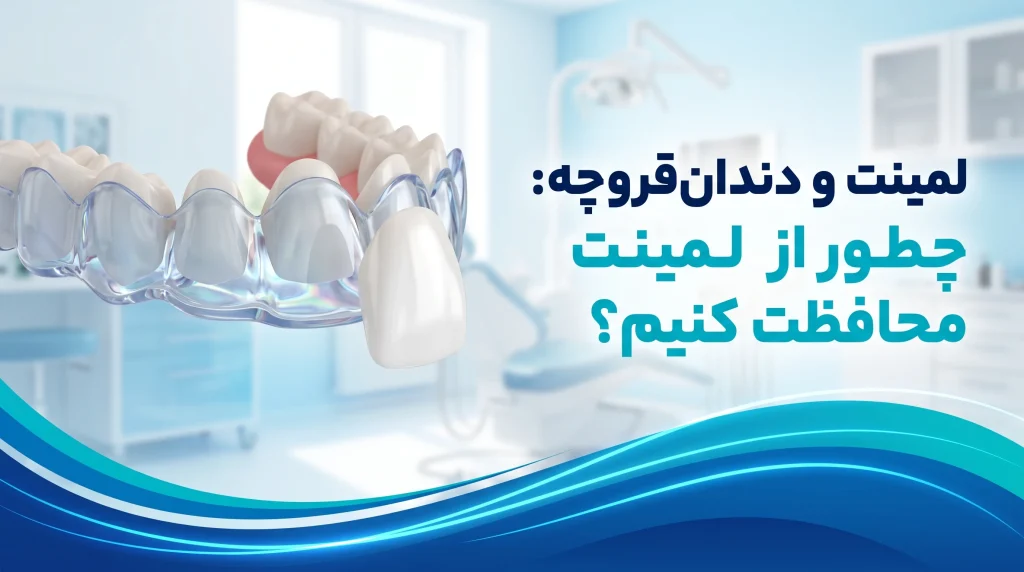 لمینت و دندان‌قروچه - محافظت از لمینت با نایت گارد و نمایش دندان‌های لمینت شده